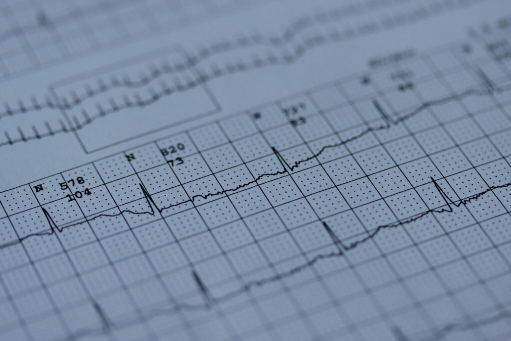 ekg