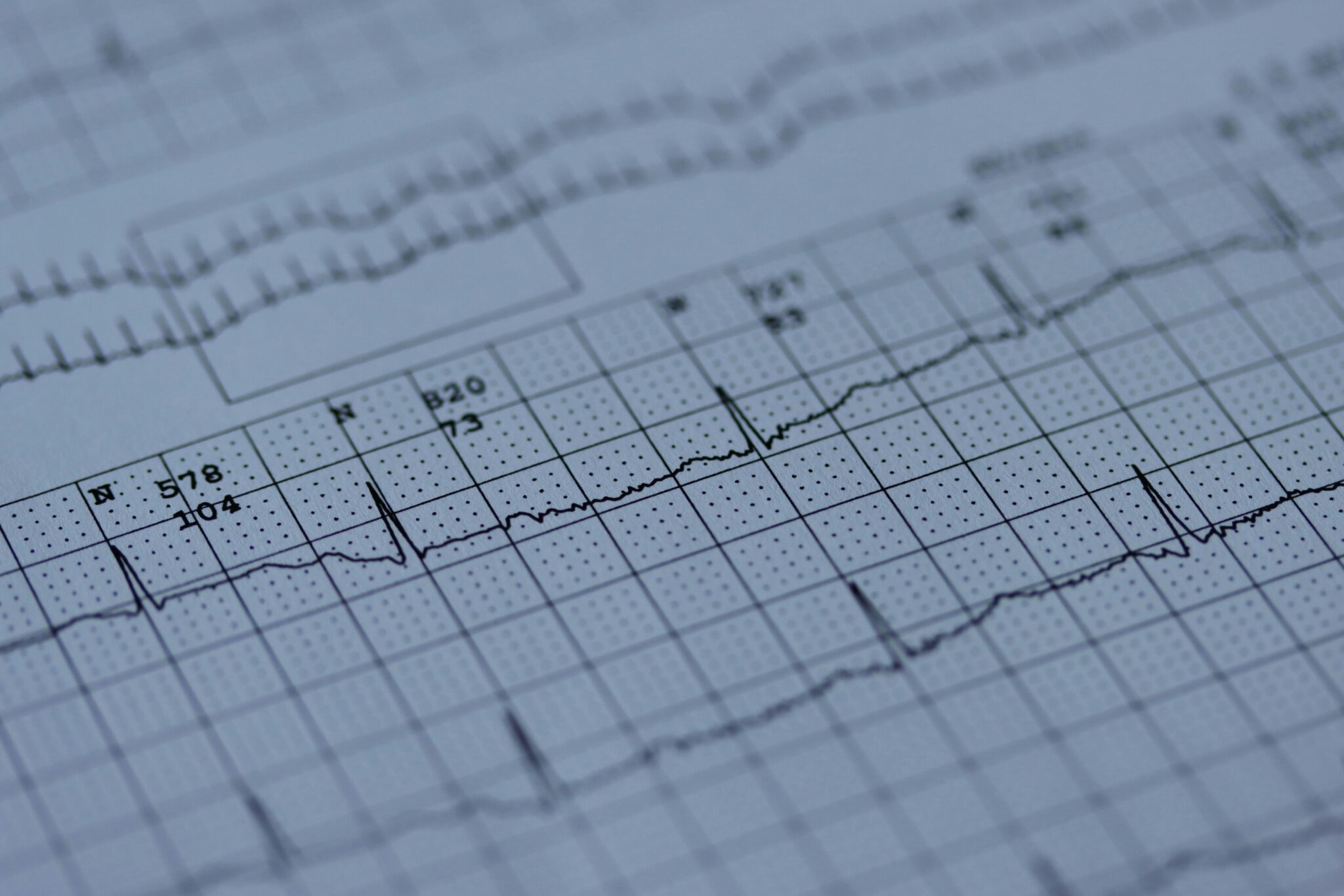 Mobile Cardiac Telemetry – Essience Diagnostics